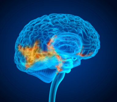 ÅRSAK I HJERNEN: Psykogene faktorer er svært vanlig årsak. Illustrasjon: NTB Scanpix/Shutterstock ÅRSAK I HJERNEN: Psykogene faktorer er svært vanlig årsak. Illustrasjon: NTB Scanpix/Shutterstock